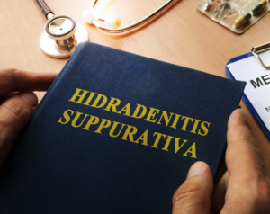 textbook hidradenitis suppurativa cases